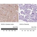 SCG3 Antibody in Immunohistochemistry (IHC)
