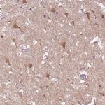 SCG3 Antibody in Immunohistochemistry (IHC)
