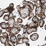 HAI-1 Antibody in Immunohistochemistry (Paraffin) (IHC (P))