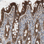 HAI-1 Antibody in Immunohistochemistry (Paraffin) (IHC (P))