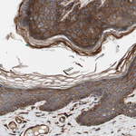 HAI-1 Antibody in Immunohistochemistry (Paraffin) (IHC (P))