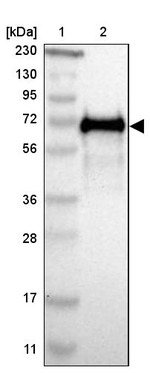 HAI-1 Antibody in Western Blot (WB)