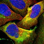 HAI-1 Polyclonal Antibody