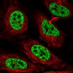 MKX Antibody in Immunocytochemistry (ICC/IF)