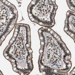 MKX Antibody in Immunohistochemistry (Paraffin) (IHC (P))