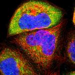 USP31 Polyclonal Antibody