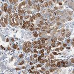 PBXIP1 Antibody in Immunohistochemistry (Paraffin) (IHC (P))