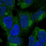 ZNF135 Polyclonal Antibody