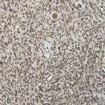 ZNF135 Antibody in Immunohistochemistry (Paraffin) (IHC (P))