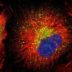 RAB7 Polyclonal Antibody