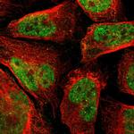 PHC1 Polyclonal Antibody