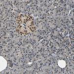 PHC1 Antibody in Immunohistochemistry (Paraffin) (IHC (P))