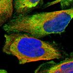 LRRFIP1 Polyclonal Antibody