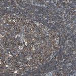 LRRFIP1 Antibody in Immunohistochemistry (Paraffin) (IHC (P))