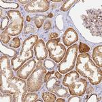 YY1AP1 Polyclonal Antibody