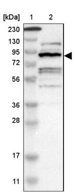 ZHX2 Antibody in Western Blot (WB)