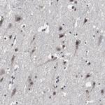 MED27 Antibody in Immunohistochemistry (Paraffin) (IHC (P))