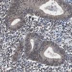 MED27 Antibody in Immunohistochemistry (Paraffin) (IHC (P))