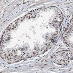 MED27 Antibody in Immunohistochemistry (Paraffin) (IHC (P))