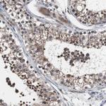 MED27 Antibody in Immunohistochemistry (Paraffin) (IHC (P))