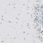 ZNF131 Antibody in Immunohistochemistry (Paraffin) (IHC (P))