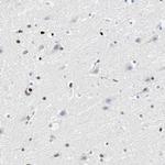 ZNF131 Antibody in Immunohistochemistry (Paraffin) (IHC (P))