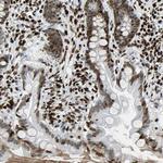 ZNF131 Antibody in Immunohistochemistry (Paraffin) (IHC (P))