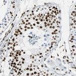 ZNF131 Antibody in Immunohistochemistry (Paraffin) (IHC (P))