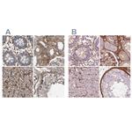 COL6A2 Polyclonal Antibody