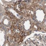 COL6A2 Antibody in Immunohistochemistry (IHC)