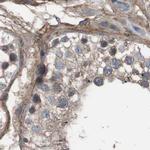 COL6A2 Antibody in Immunohistochemistry (IHC)