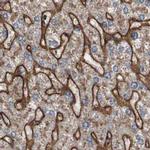 COL6A2 Antibody in Immunohistochemistry (IHC)
