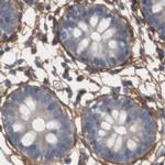 COL6A2 Antibody in Immunohistochemistry (IHC)