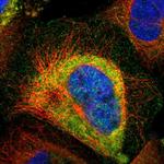 Centaurin alpha-1 Polyclonal Antibody