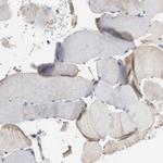 Centaurin alpha-1 Antibody in Immunohistochemistry (Paraffin) (IHC (P))