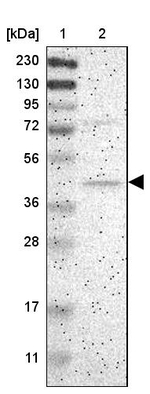 Centaurin alpha-1 Antibody in Western Blot (WB)
