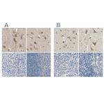 Centaurin alpha-1 Antibody in Immunohistochemistry (IHC)