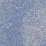 Centaurin alpha-1 Antibody in Immunohistochemistry (IHC)