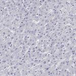 Titin Antibody in Immunohistochemistry (Paraffin) (IHC (P))