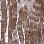 Titin Polyclonal Antibody