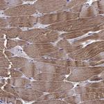 Titin Antibody in Immunohistochemistry (IHC)