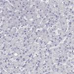 Titin Antibody in Immunohistochemistry (IHC)