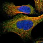 GNE Polyclonal Antibody