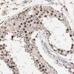 NFRKB Antibody in Immunohistochemistry (IHC)