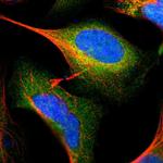 GALK1 Polyclonal Antibody