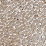 GALK1 Antibody in Immunohistochemistry (Paraffin) (IHC (P))