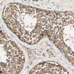 GALK1 Antibody in Immunohistochemistry (Paraffin) (IHC (P))