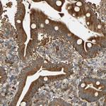 GALK1 Antibody in Immunohistochemistry (IHC)