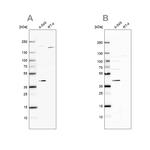 GALK1 Antibody in Western Blot (WB)