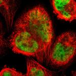 ZNF323 Polyclonal Antibody